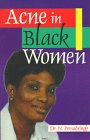 Acne in Black Women